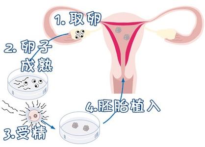 慈安中西医结合试管中心